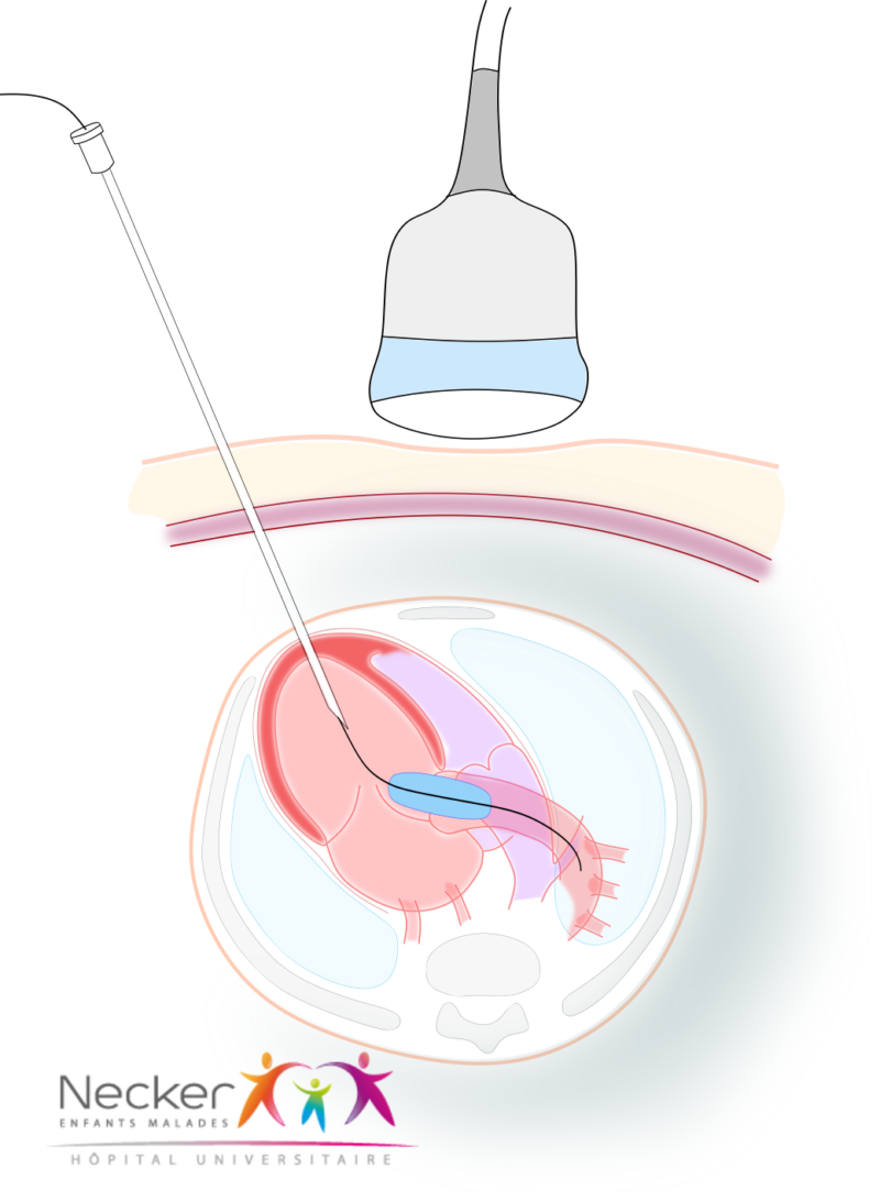 coeur_stenao-800x1093