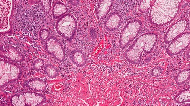 petit_intestin-1-630x350