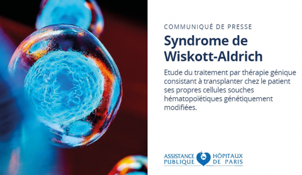 Photo Actualité syndrome de Wiskott-Aldrich